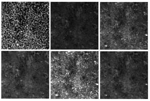Figure 2: The first six images in the RxRx1 dataset. All six images represent the same collection of HUVEC cells.