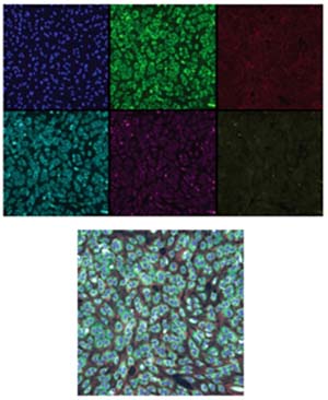 Figure 3: Top: Six RxRx1 images with false color applied. Bottom: A composite of the six images. Source: https://www.rxrx.ai