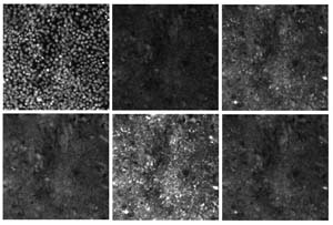 Figure 2: The first six images in the RxRx1 dataset. All six images represent the same collection of HUVEC cells.