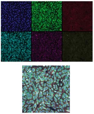 Figure 3: Top: Six RxRx1 images with false color applied. Bottom: A composite of the six images. Source: https://www.rxrx.ai